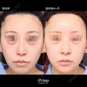 プリモ麻布十番クリニック 大場教弘医師の症例