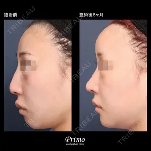 プリモ麻布十番クリニック 大場教弘医師の症例