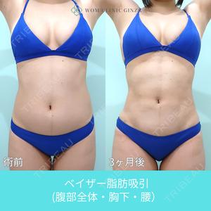 WOM CLINIC GINZA （ワム クリニック ギンザ）の症例