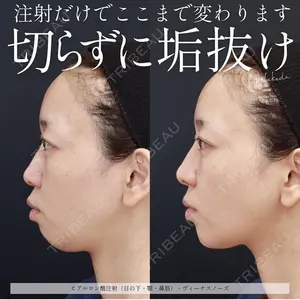 大阪TAクリニック 福田 智一医師の症例