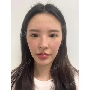 LUHO（ルホ）美容外科の症例