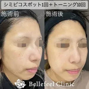 Bellefeel Clinic 代官山 兵藤 秀忠 医師の症例