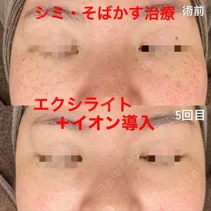 ロレシー美容クリニック 心斎橋駅前院 福留院長医師の症例