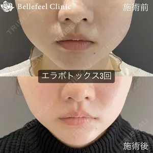 Bellefeel Clinic 代官山 兵藤 秀忠 医師の症例