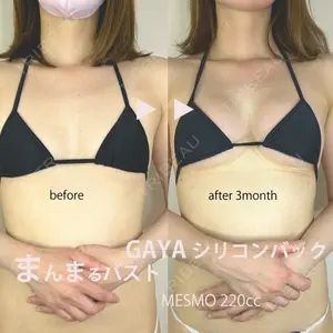 GAYA body design clinicの症例