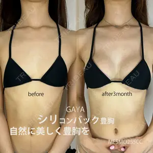 GAYA body design clinic 飯ヶ谷 重来医師の症例