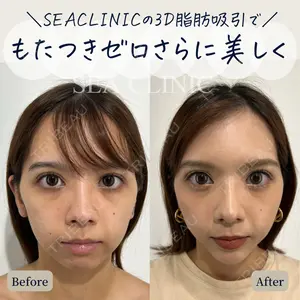 SEA CLINIC（シークリニック） 沼澤 茂医師の症例