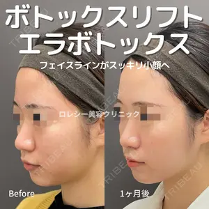 ロレシー美容クリニック 心斎橋駅前院 高田先生医師の症例