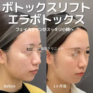 ロレシー美容クリニック 心斎橋駅前院 高田先生医師の症例