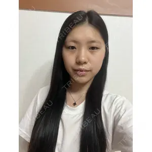LUHO（ルホ）美容外科の症例