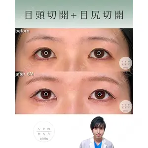 くさのたろうクリニックの症例
