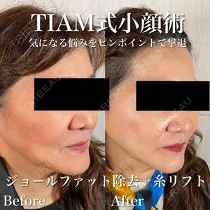 TIAM CLINIC GINZA 谷口 弘樹医師の症例