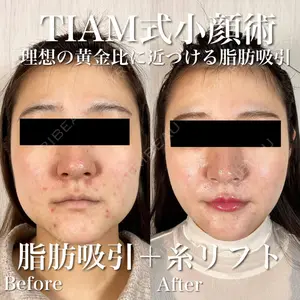 TIAM CLINIC GINZA 谷口 弘樹医師の症例