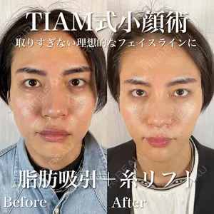 TIAM CLINIC GINZAの症例