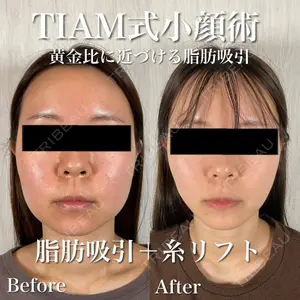 TIAM CLINIC GINZA 谷口 弘樹医師の症例