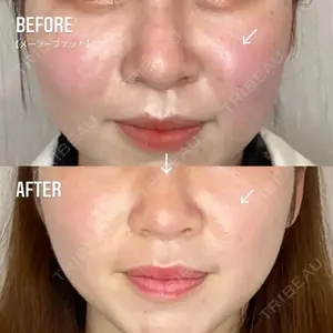 TIAM CLINIC GINZA 谷口 弘樹医師の症例