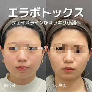 ロレシー美容クリニック 心斎橋駅前院 高田先生医師の症例
