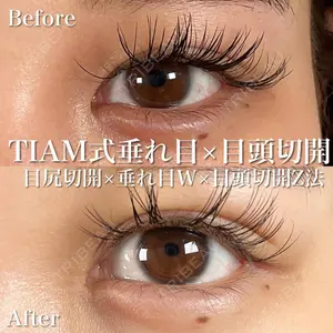 TIAM CLINIC GINZA 谷口 弘樹医師の症例