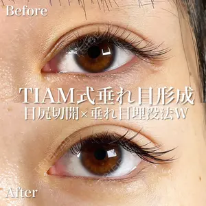 TIAM CLINIC GINZA 谷口 弘樹医師の症例