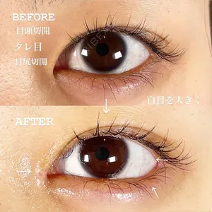 TIAM CLINIC GINZA 谷口 弘樹医師の症例