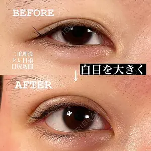 TIAM CLINIC GINZA 谷口 弘樹医師の症例