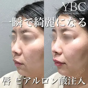 YBC横浜美容外科 大宮院 磯村 亮輔医師の症例