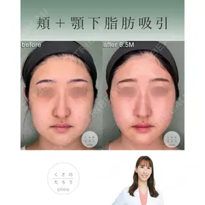 くさのたろうクリニック 立雅恵医師の症例
