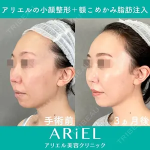 アリエル美容クリニック 大宮院 鈴木　桂介医師の症例