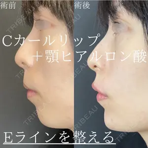ルラ美容クリニック 広島院の症例