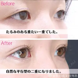 東京形成美容外科 銀座院 弓削田　浩主医師の症例