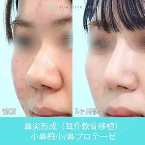 WOM CLINIC GINZA （ワム クリニック ギンザ） 佐々木 和司医師の症例