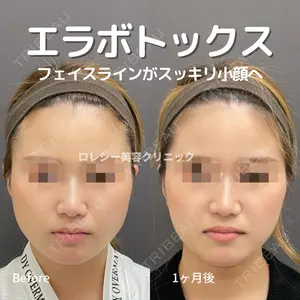 ロレシー美容クリニック 心斎橋駅前院 高田先生医師の症例