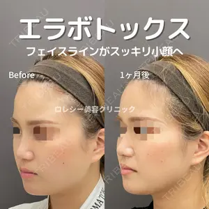 ロレシー美容クリニック 心斎橋駅前院 高田先生医師の症例