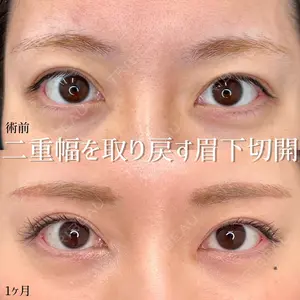 東京シンデレラ美容外科 大宮院の症例