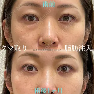 お茶の水美容形成クリニック 吉井 健吾医師の症例