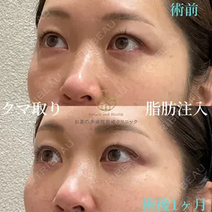 お茶の水美容形成クリニック 吉井 健吾医師の症例