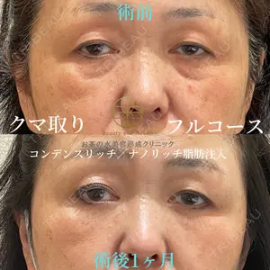 お茶の水美容形成クリニック 吉井 健吾医師の症例