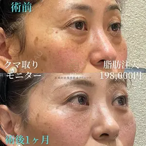 お茶の水美容形成クリニック 吉井 健吾医師の症例