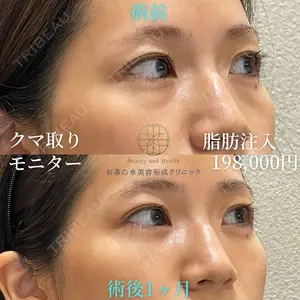 お茶の水美容形成クリニック 吉井 健吾医師の症例
