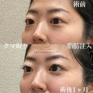 お茶の水美容形成クリニック 吉井 健吾医師の症例