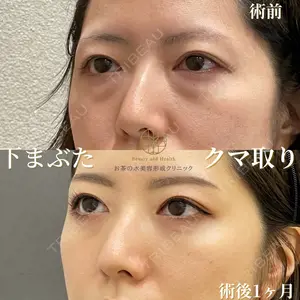 お茶の水美容形成クリニック 吉井 健吾医師の症例