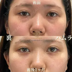 お茶の水美容形成クリニック 吉井 健吾医師の症例