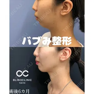 BLINC CLINIC （ブリンク クリニック） 柳川 央徒医師の症例