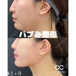 BLINC CLINIC （ブリンク クリニック） 柳川 央徒医師の症例