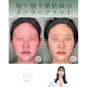 くさのたろうクリニック 立雅恵医師の症例
