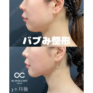 BLINC CLINIC （ブリンク クリニック） 柳川 央徒医師の症例