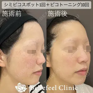 Bellefeel Clinic 代官山 兵藤 秀忠 医師の症例