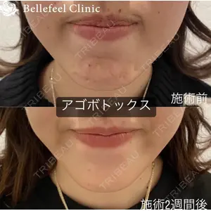 Bellefeel Clinic 代官山 兵藤 秀忠 医師の症例