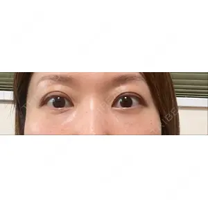 X CLINIC X CLINIC 銀座院口コミ