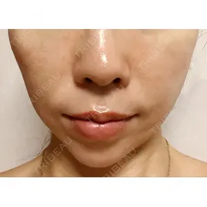 X CLINIC X CLINIC 恵比寿院口コミ